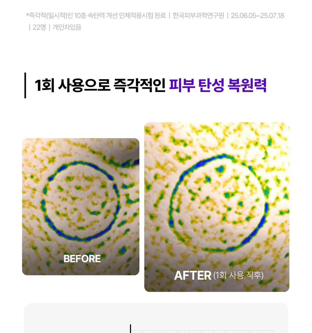 [1등 장벽PDRN/푸린백팩] 센텔리안24 마데카 크림 액티브 리뉴 PDRN 50ml 기획 (+15ml 포켓몬 에디션) 상세페이지 42